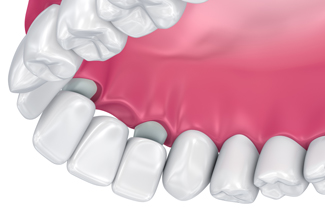 dental-emergency-mackay