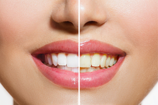 teenager-visits-dentist-mackay