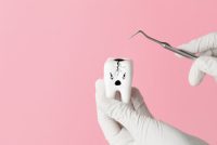 Decay Tooth Treatment check